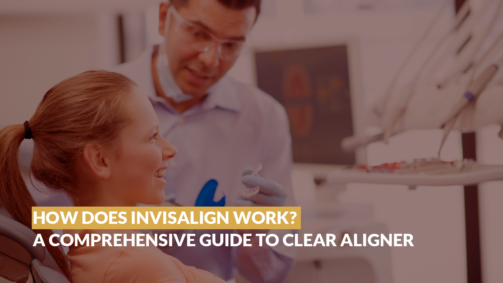 How Does Invisalign Work? A Comprehensive Guide to Clear Aligner