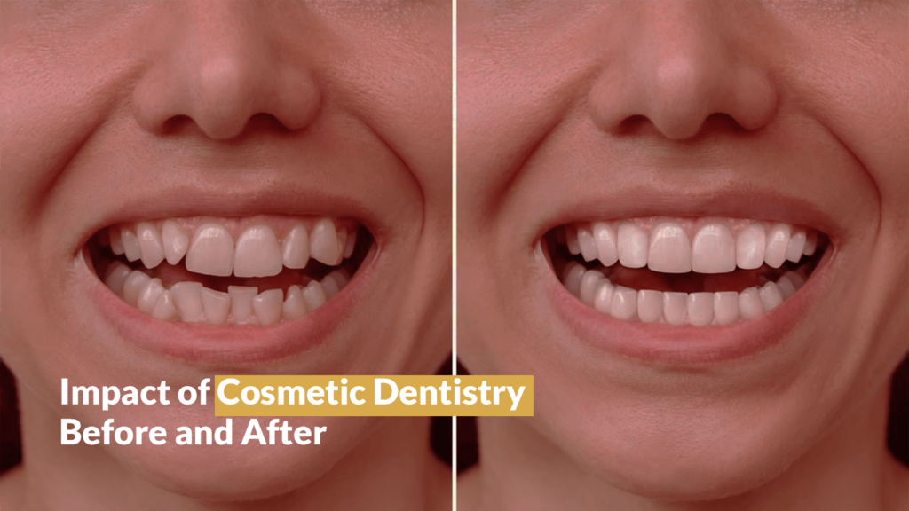 IMPACT OF COSMETIC DENTISTRY BEFORE AND AFTER - Sherman Oaks Smile Studio