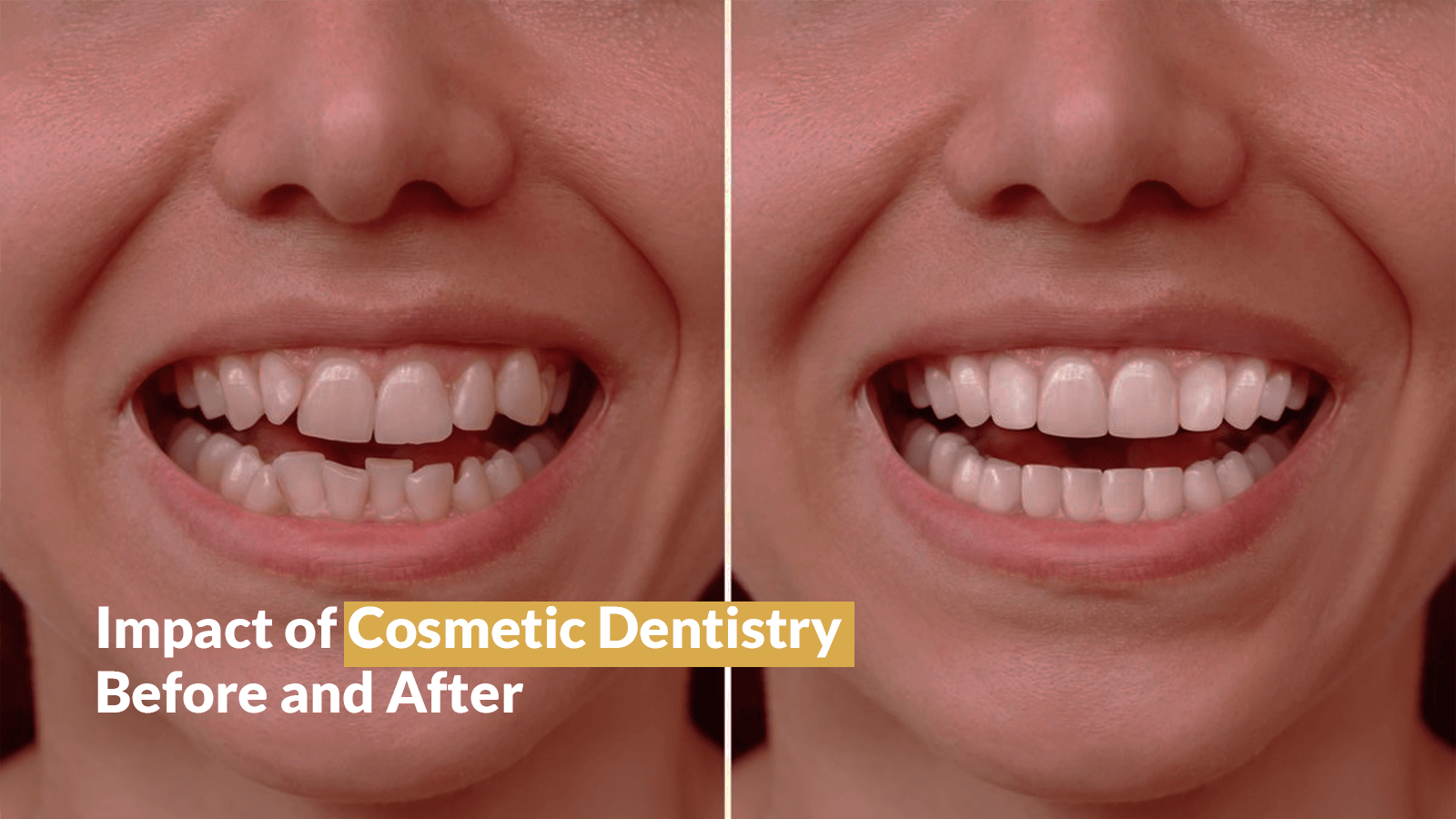 Impact of Cosmetic Dentistry Before and After