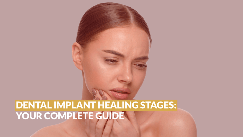 DENTAL IMPLANT HEALING STAGES: YOUR COMPLETE GUIDE - Sherman Oaks Smile Studio