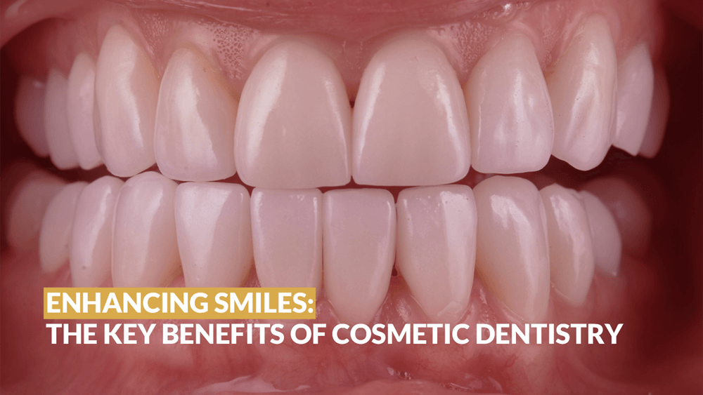 Enhancing Smiles: The Key Benefits of Cosmetic Dentistry