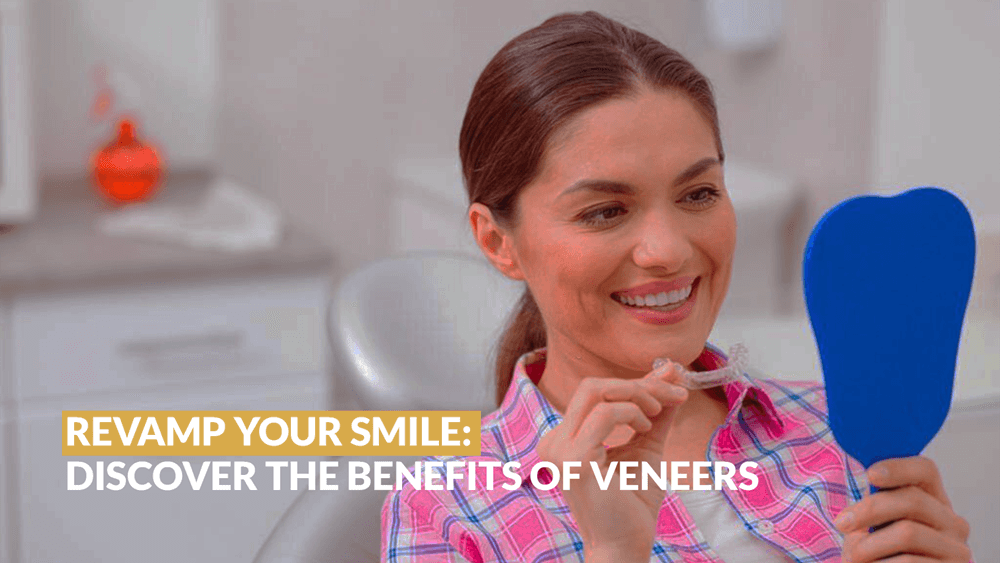 Revamp Your Smile: Discover the Benefits of Veneers