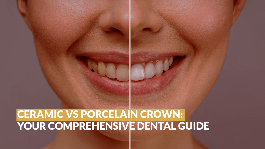 Ceramic vs Porcelain Crown: Your Comprehensive Dental Guide - Sherman Oaks Smile Studio