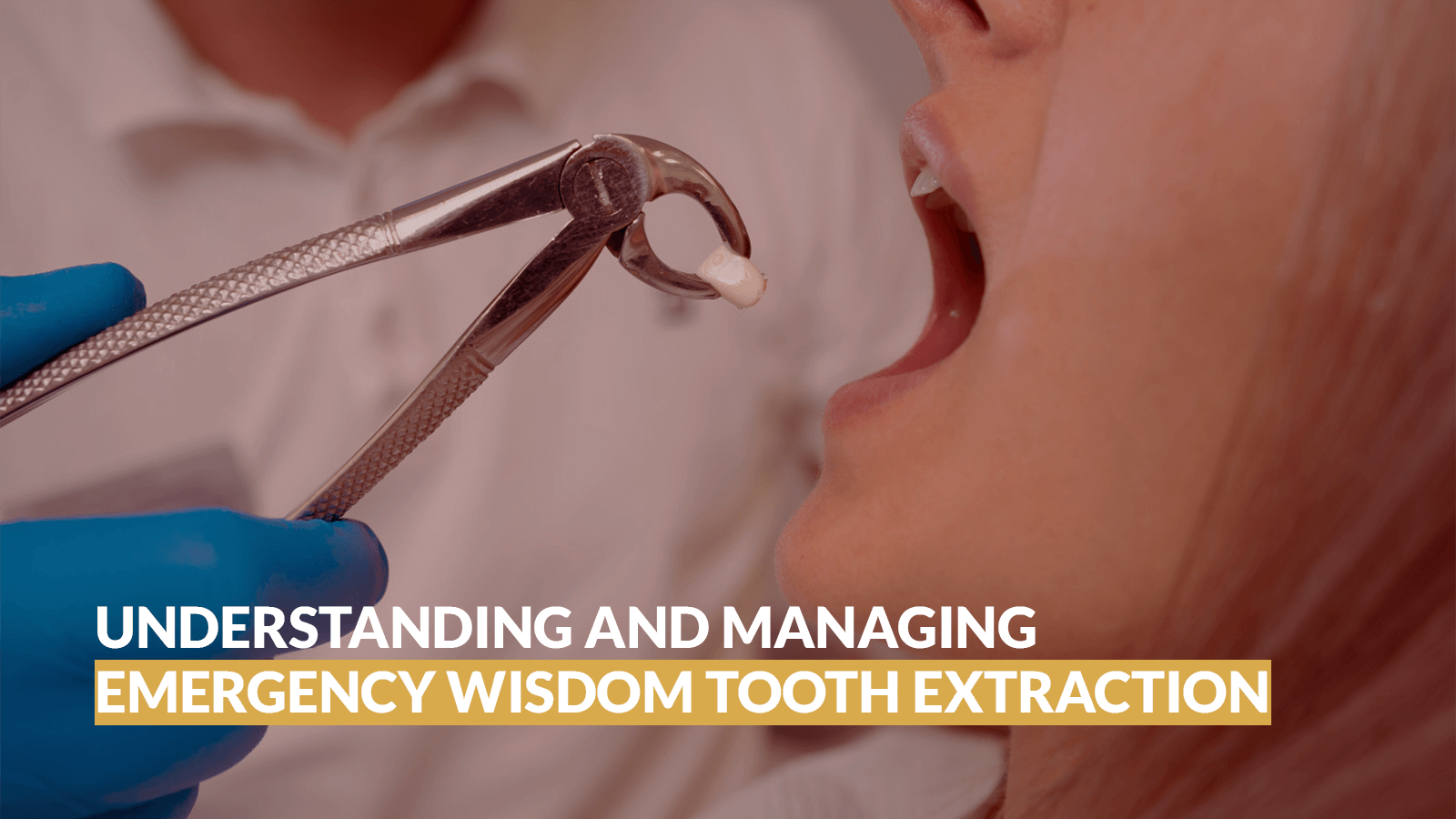 Understanding and Managing Emergency Wisdom Tooth Extraction