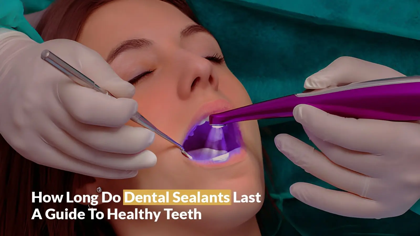 How Long Do Dental Sealants Last? | What is Dental Sealants?