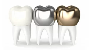 porcelain, silver and gold dental crowns