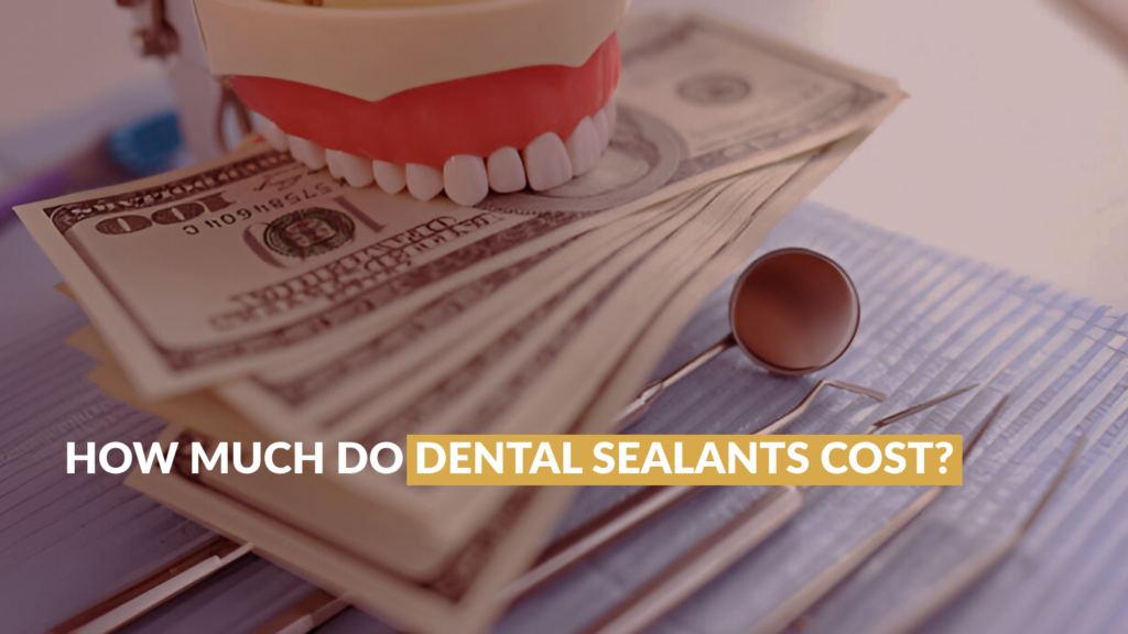 How Much Do Dental Sealants Cost