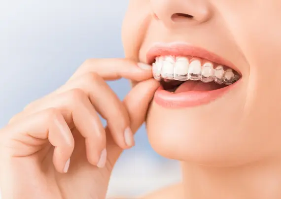 Invisalign sherman oaks - Sherman Oaks Smile Studio