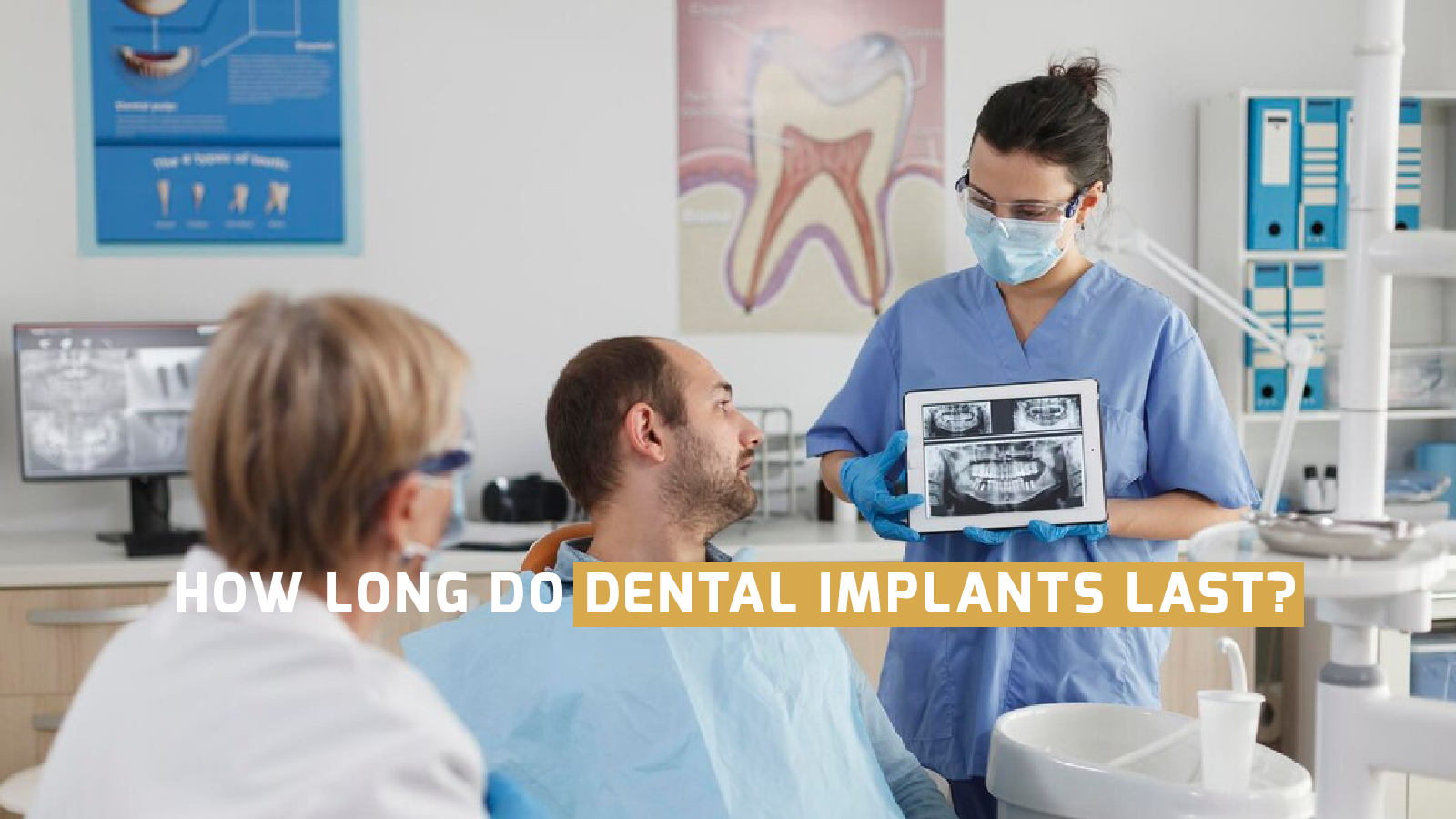 How Long Do Dental Implants Last?