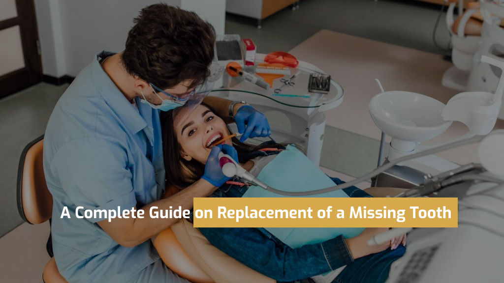 A Complete Guide on Replacement of a Missing Tooth