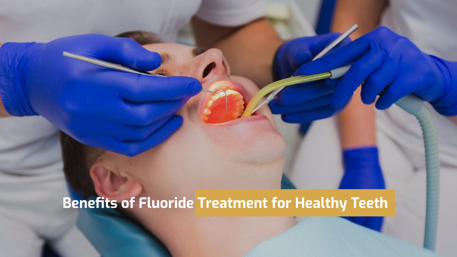 The Incredible Benefits of Fluoride Treatment for Healthy Teeth