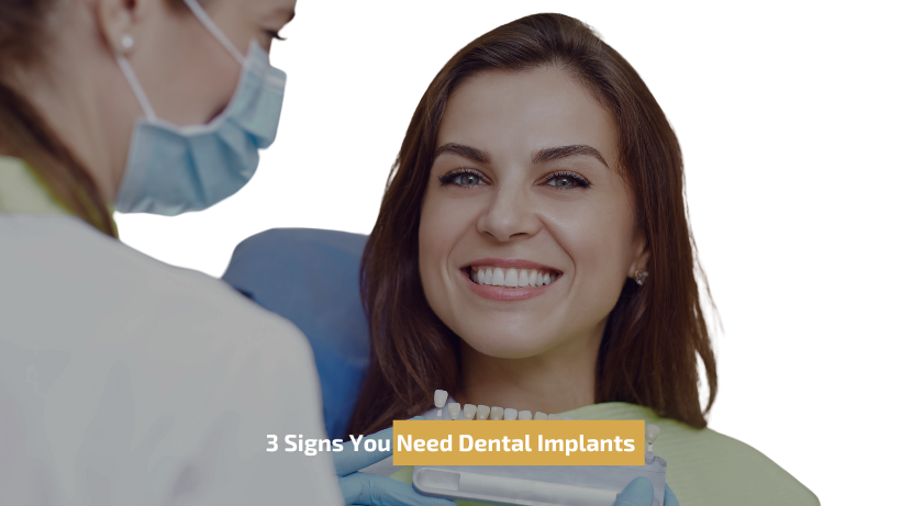 3 Signs You Need Dental Implants