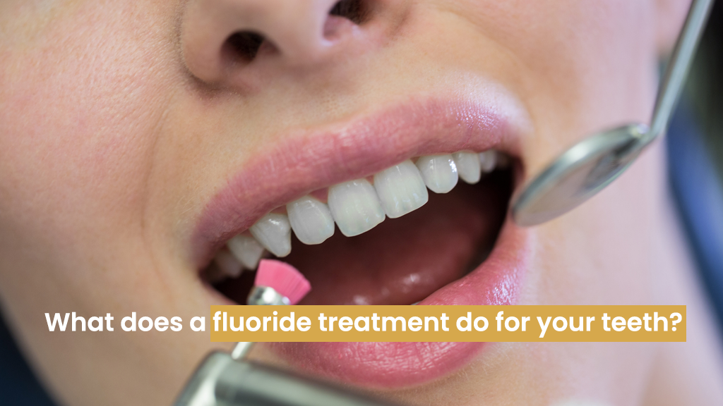 What does a fluoride treatment do for your teeth?