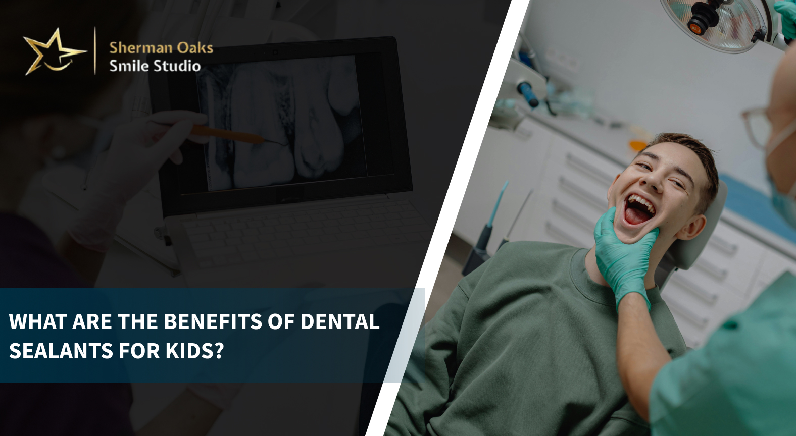 Benefits of Dental Sealants