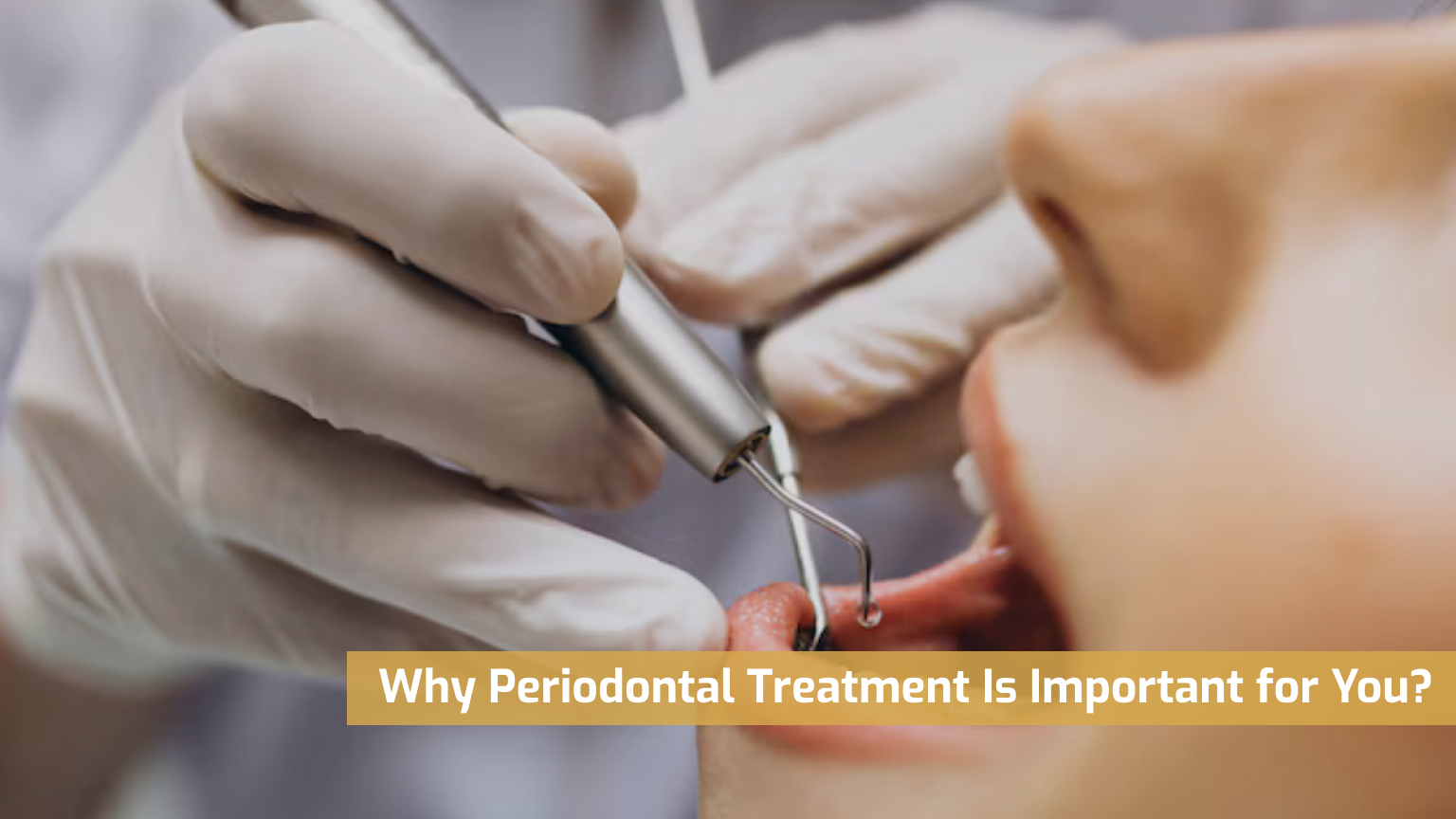 Why Periodontal Treatment Is Important for You?