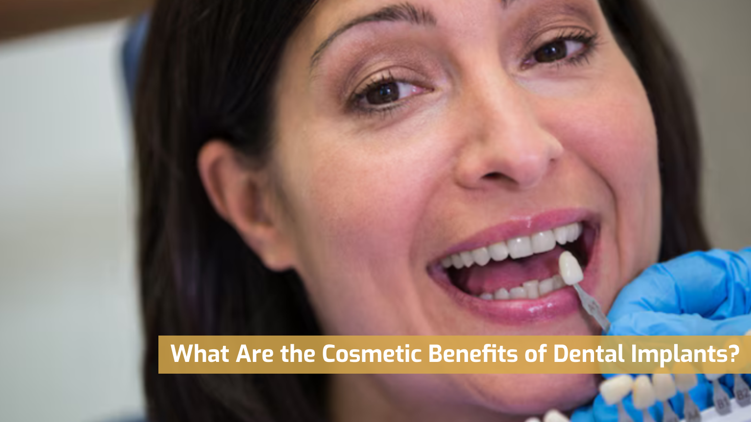 What Are the Cosmetic Benefits of Dental Implants?