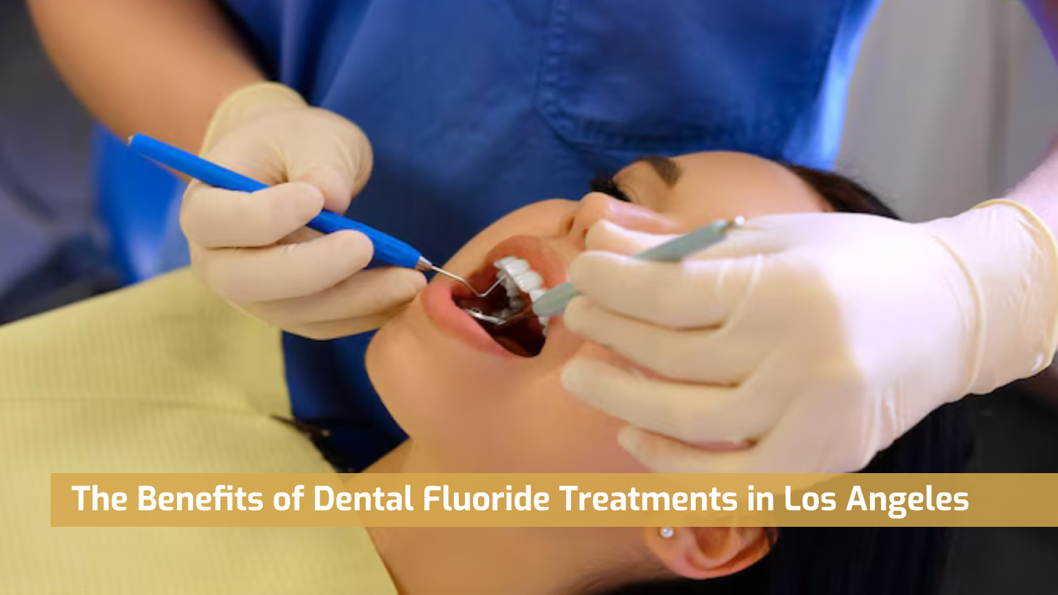 The Benefits of Dental Fluoride Treatments in Los Angeles
